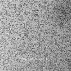 人脑星形胶质母细胞瘤细胞,U-87 MG