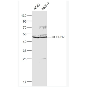 GOLPH2 高尔基体膜蛋白GP73抗体