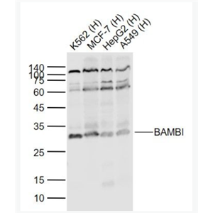 BAMBI 肿瘤转移抑制蛋白BAMBI抗体
