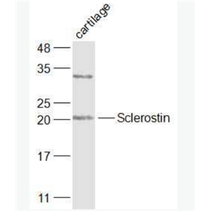 Sclerostin 骨形态发生抑制蛋白SOST抗体
