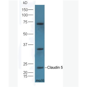 Claudin 5 紧密连接蛋白5抗体