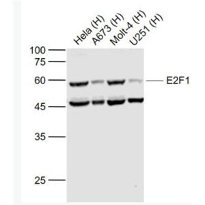 E2F1 转录因子E2F-1抗体,E2F1