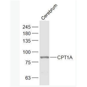 CPT1A 肉毒碱棕榈酰基转移酶1A抗体