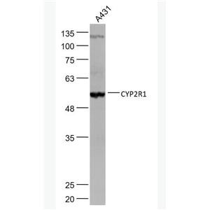 CYP2R1 细胞色素P450 2R1抗体