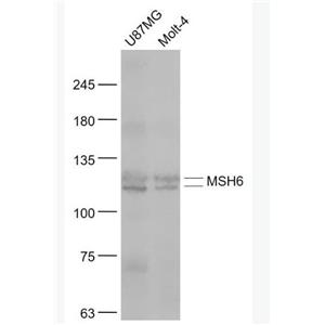 MSH6 错配修复蛋白6抗体