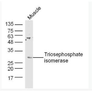 Triosephosphate isomerase 磷酸丙糖异构酶抗体