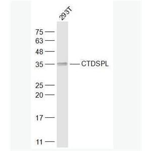 CTDSPL 联会复合体蛋白3抗体