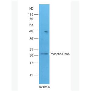 Phospho-RhoA (Ser188) 磷酸化RhoA蛋白抗体,Phospho-RhoA (Ser188)