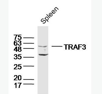 TRAF3 肿瘤坏死因子受体相关蛋白3抗体,TRAF3