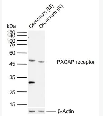 PACAP receptor 腺苷酸环化酶激活肽受体1抗体,PACAP receptor