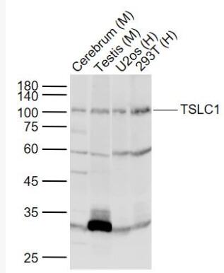 TSLC1 細(xì)胞粘附分子1抗體,TSLC1