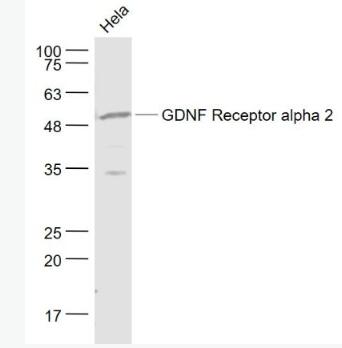 GDNF Receptor alpha 2 胶质细胞系源性神经营养因子受体α2抗体,GDNF Receptor alpha 2