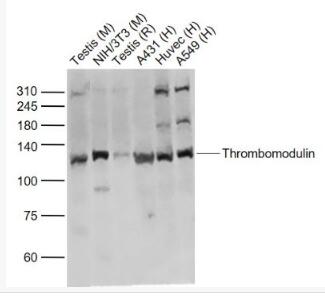 Thrombomodulin 血栓调节蛋白抗体,Thrombomodulin