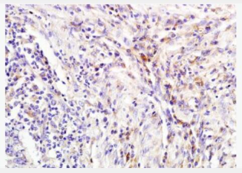 Lipocalin 2/NGAL 脂质运载蛋白抗体,Lipocalin 2/NGAL