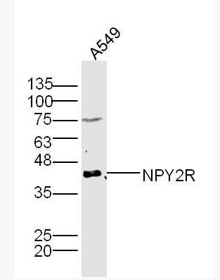 NPY2R 神经肽Y受体2抗体,NPY2R