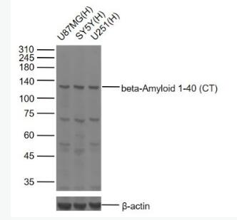 beta-Amyloid 1-40 (CT) β淀粉样肽1-40 C端/Aβ1-40 C端抗体,beta-Amyloid 1-40 (CT)