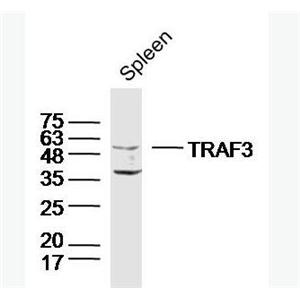 TRAF3 肿瘤坏死因子受体相关蛋白3抗体