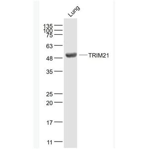 TRIM21 核糖核蛋白自身抗原抗体
