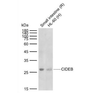 CIDEB 细胞死亡激活剂CIDE-B抗体