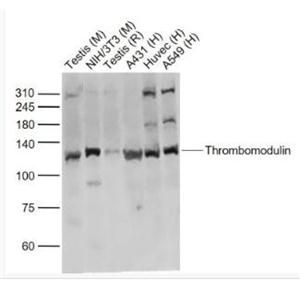 Thrombomodulin 血栓调节蛋白抗体,Thrombomodulin