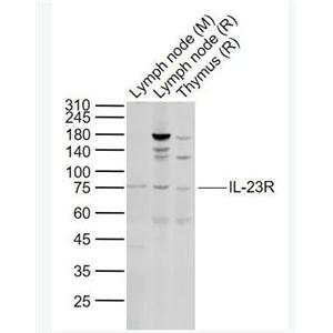 IL-23R 白介素-23受体抗体,IL-23R