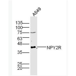 NPY2R 神经肽Y受体2抗体