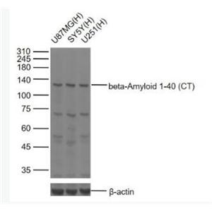 beta-Amyloid 1-40 (CT)  β淀粉样肽1-40 C端/Aβ1-40 C端抗体