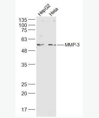 MMP3 基质金属蛋白酶3抗体,MMP3