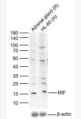 MIF 巨噬细胞移动抑制因子抗体,MIF