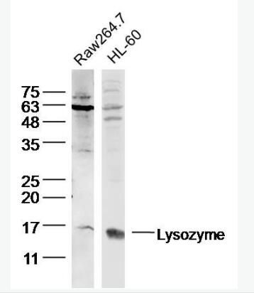 Lysozyme 溶菌酶抗体,Lysozyme