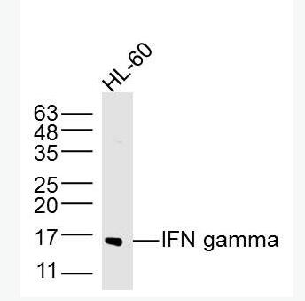 IFN gamma 干扰素-γ/IFN-γ抗体,IFN gamma