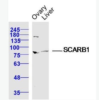 SCARB1/Scavenger Receptor BI 高密度脂蛋白受体/清道夫受体抗体,SCARB1/Scavenger Receptor BI