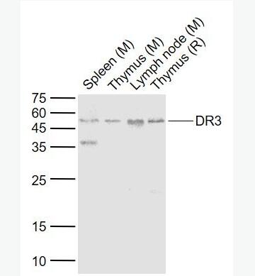 DR3 死亡受体3抗体,DR3
