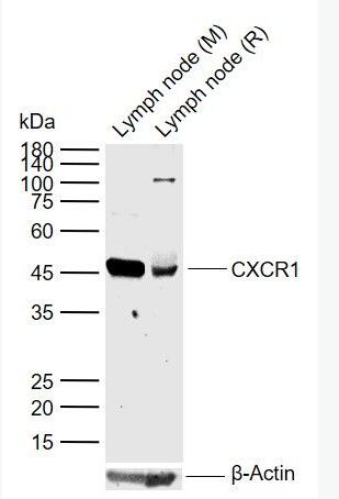 CXCR1 细胞表面趋化因子受体1抗体,CXCR1