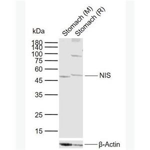 NIS 钠碘转运体蛋白抗体