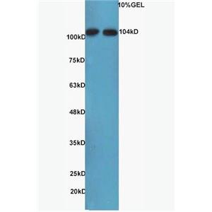 MAP3K14/NFkB Inducing Kinase NFkB誘導(dǎo)激酶抗體,MAP3K14/NFkB Inducing Kinase