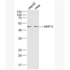 MMP3 基质金属蛋白酶3抗体,MMP3