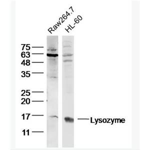 Lysozyme 溶菌酶抗体,Lysozyme