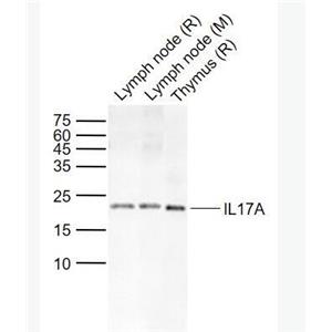  IL17A 白介素-17抗体
