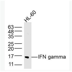 IFN gamma 干扰素-γ/IFN-γ抗体