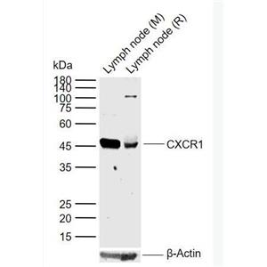 CXCR1 细胞表面趋化因子受体1抗体,CXCR1