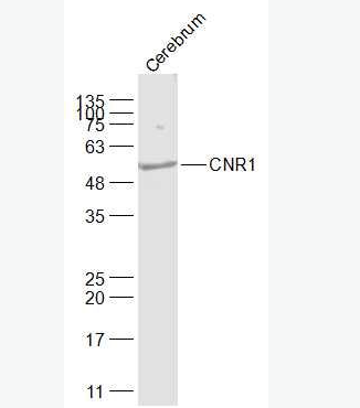 Anti-CNR1 antibody - 鈣粘蛋白相關(guān)的神經(jīng)受體1抗體,CNR1