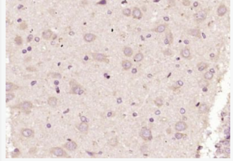 Anti-NMDAR1 antibody -离子型谷氨酸受体1抗体,NMDAR1