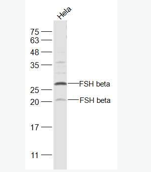 Anti-FSH beta antibody -促卵泡刺激素抗体,FSH beta
