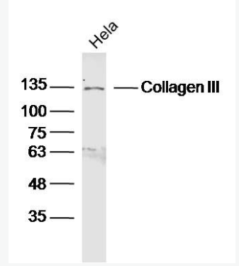 Anti-Collagen III antibody -Ⅲ型胶原蛋白/胶原蛋白3/3型胶原蛋白抗体,Collagen III