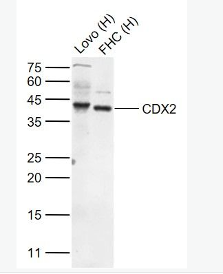 Anti-CDX2 antibody -尾型同源盒转录因子2抗体,CDX2