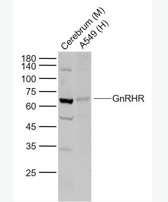 Anti-GnRHR antibody -促性腺激素释放激素受体抗体,GnRHR