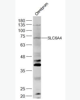 Anti-Serotonin transporter antibody -5-羟色胺转运蛋白抗体,Serotonin transporter