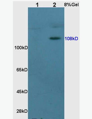 Anti-NR3C2/Mineralocorticoid receptor antibody -鹽皮質(zhì)激素受體抗體,NR3C2/Mineralocorticoid receptor