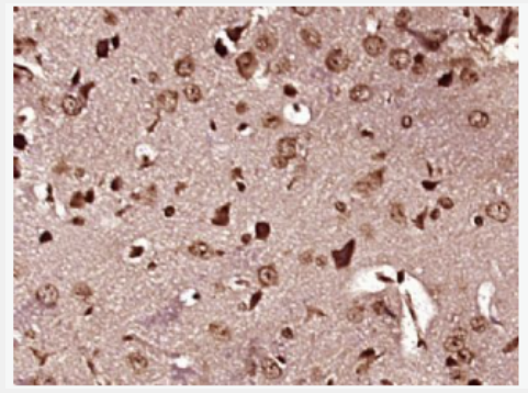 Anti-alpha MSH antibody -促黑細(xì)胞激素α抗體,alpha MSH